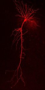 SFB Members demonstrate link between structural degeneration of dendrites and hyperexcitability in an Alzheimers model SFB Members demonstrate link between structural degeneration of dendrites and hyperexcitability in an Alzheimers model